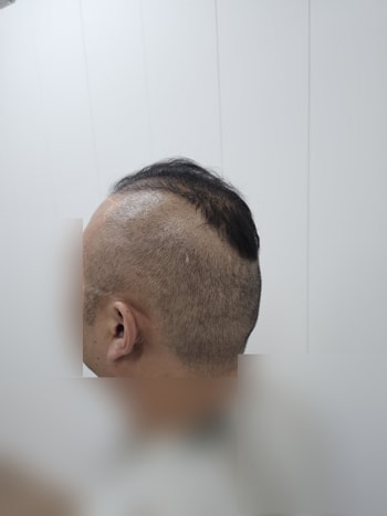 옆쪽에서 보면 3일만 지나도 이렇게 위로 갈수록 밀도가 떨어지는게 확 와 닿네요