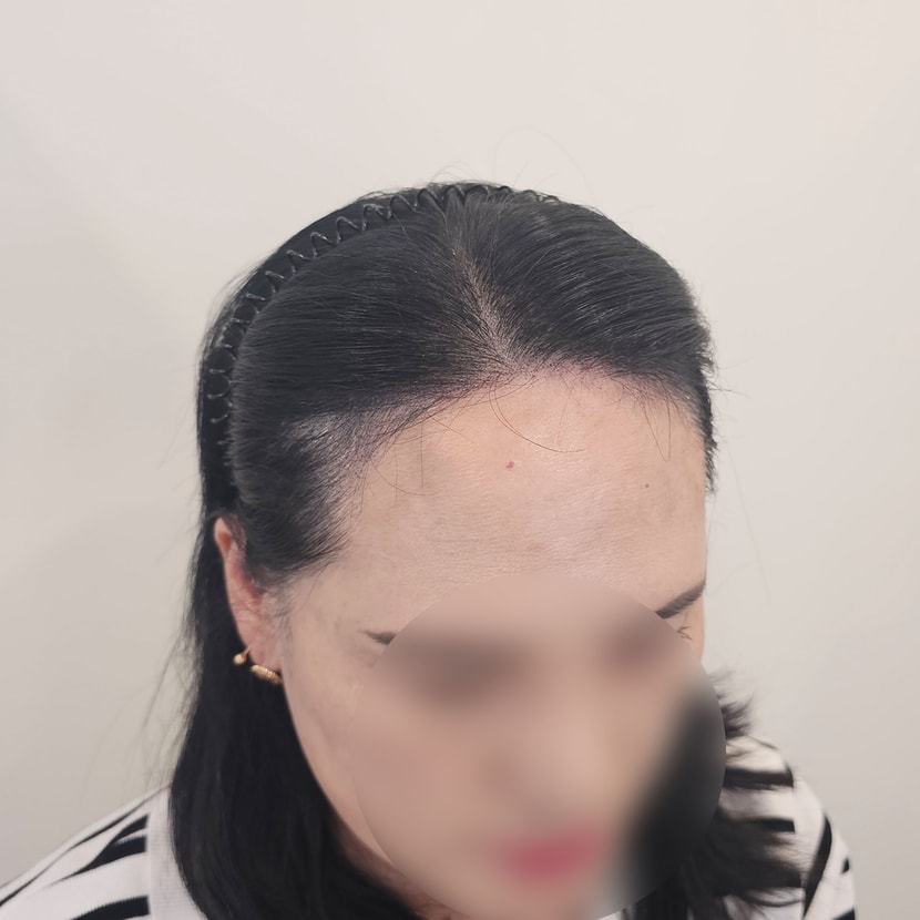 에프터