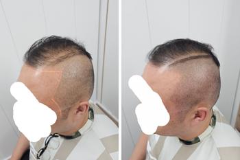 옆머리 뒷머리만 머리숱이 많아서 그냥 기르고 다니면 위에 가 되게 휑했습니다