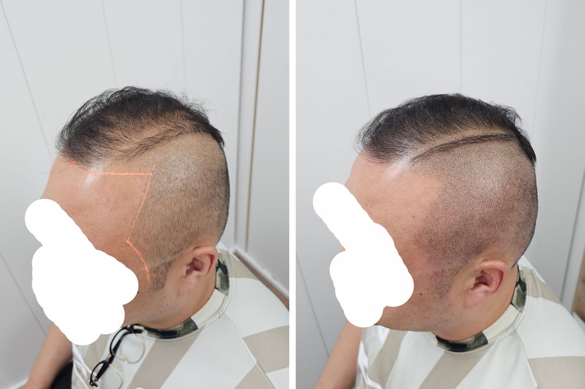 옆머리 뒷머리만 머리숱이 많아서 그냥 기르고 다니면 위에 가 되게 휑했습니다