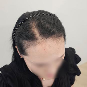 이건 비포