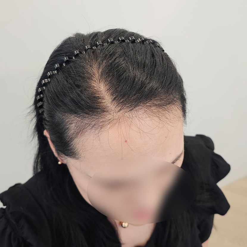 이건 비포