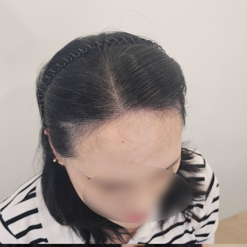 에프터