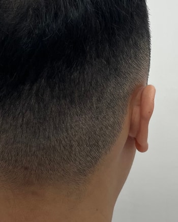 후
