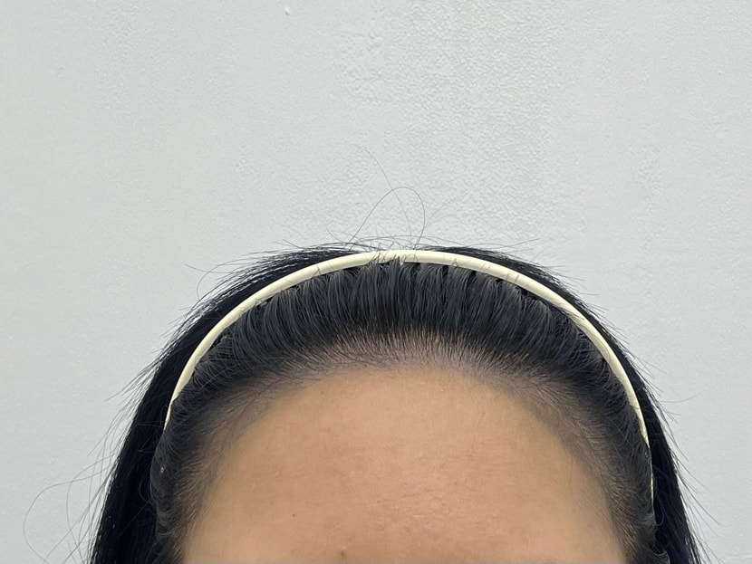 후