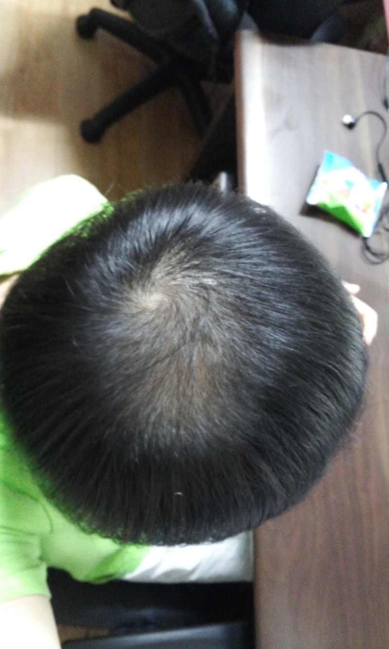 가발 고민하고 있습니다. 조언 부탁드립니다.