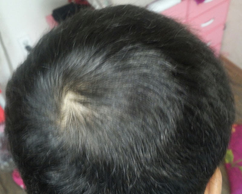 지금현재 제 머리 상태이구요..