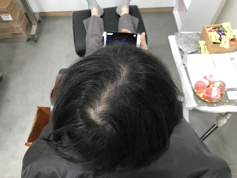 시술 전 (물기 x)