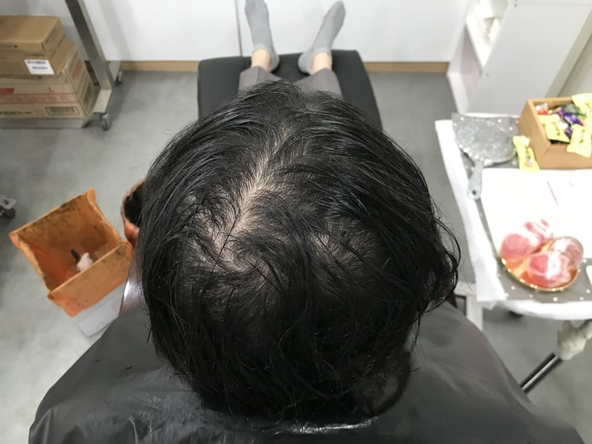 시술 전 (젖었을 때)