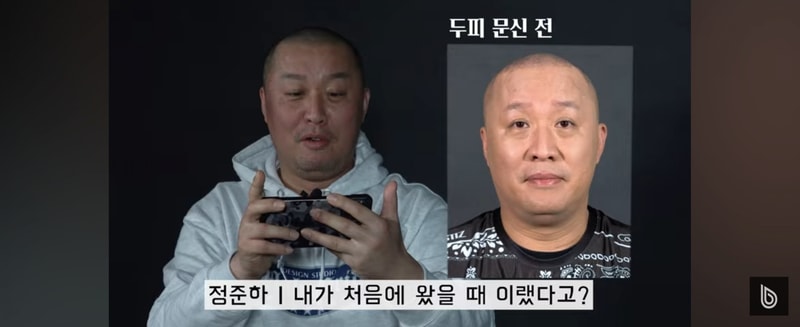 >>[Free] Incheon SMP scalp tattoo shaved head model