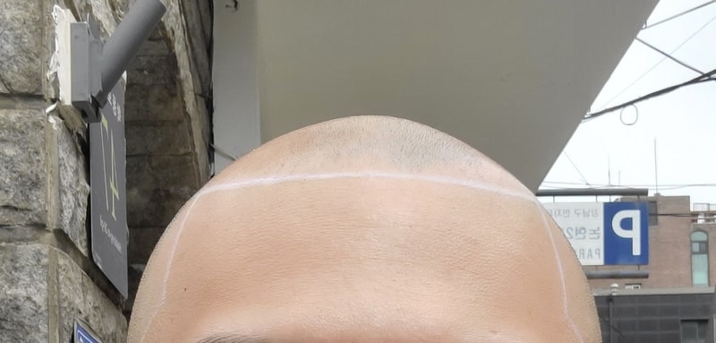 내돈내산 smp삭발 후기입니다