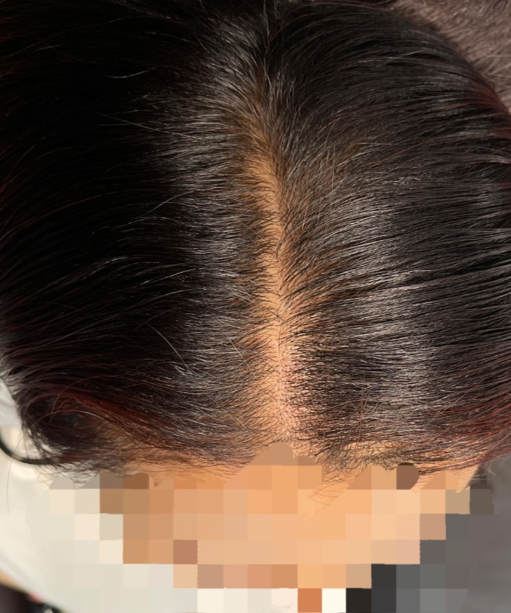 고민끝에 두피문신 질렀습니다