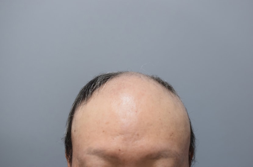 전