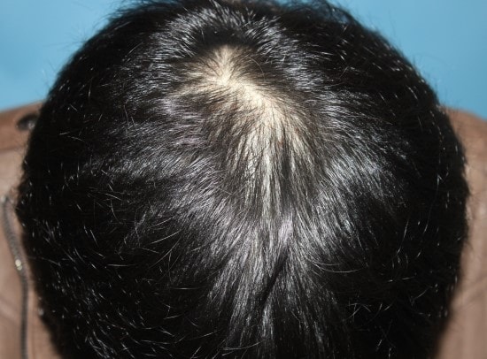 지난 주 토욜에 모제림에서 두피문신 받았어요~