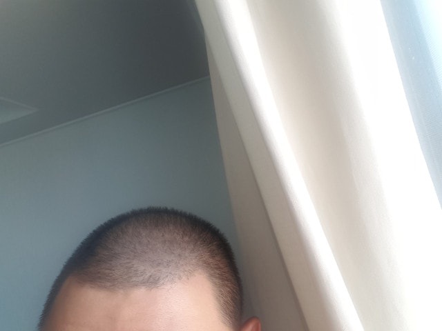 두피문신 2년차입니다  (사진)