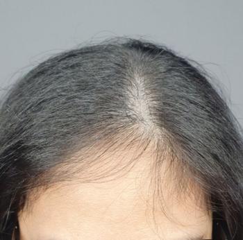 시술전사진