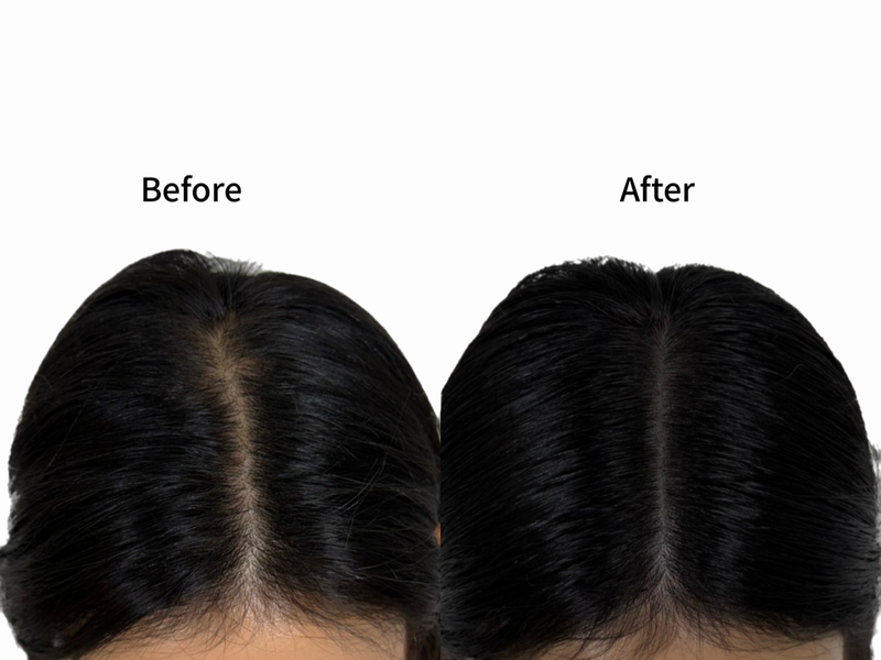 두피 채????움 모델 모집(합정역)