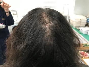 두피문신전