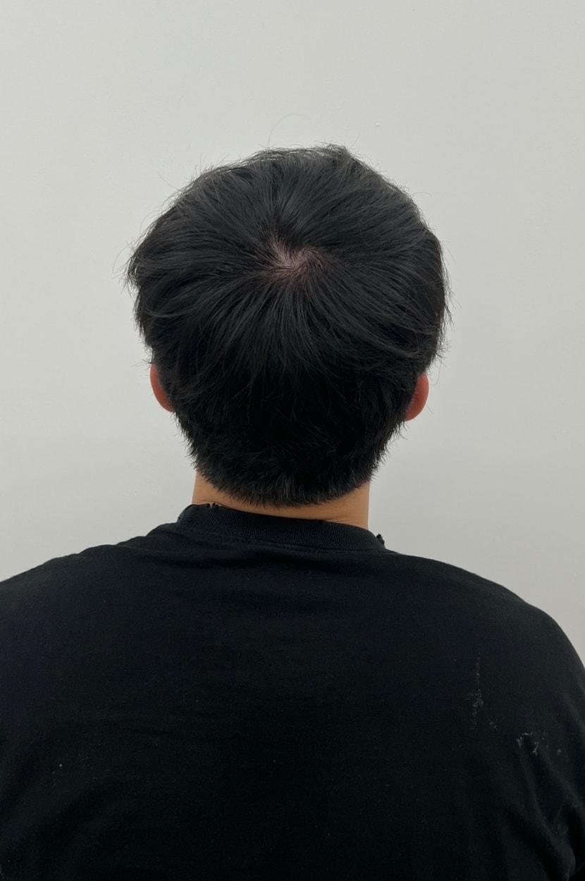 후