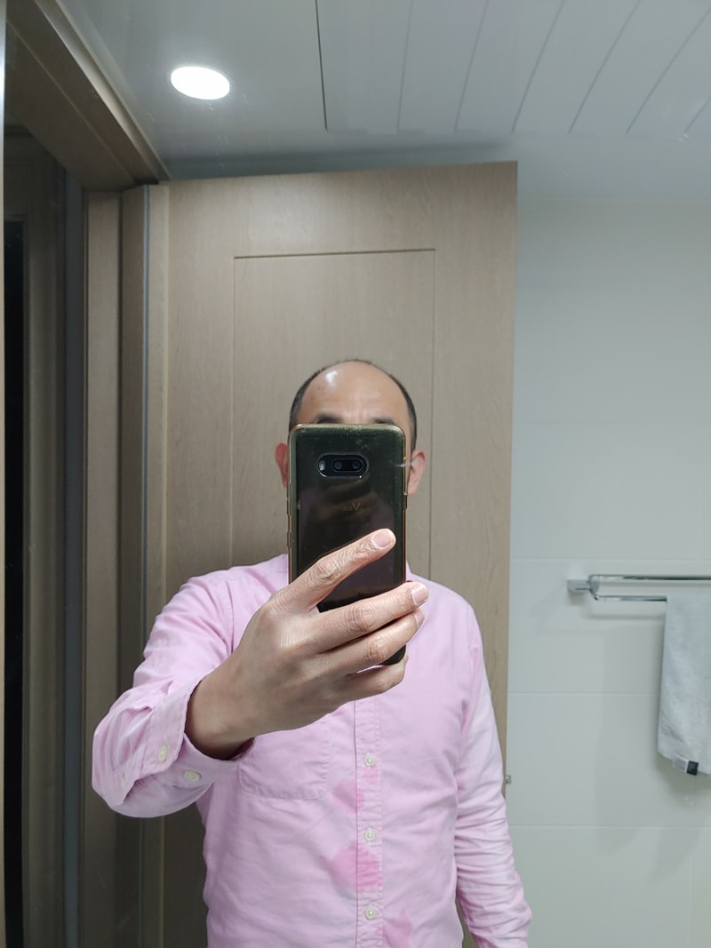 두피문신... 제가 한번 해 보았습니다.