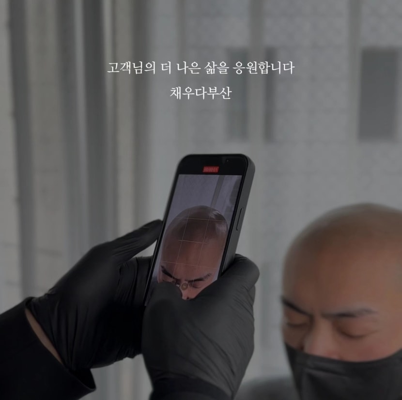 탈모커버 전문센터 채우다smp