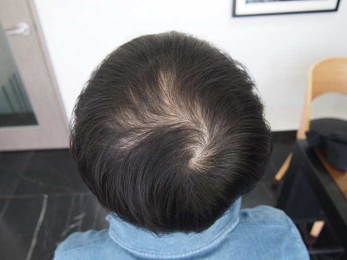 두피문신 후기입니다~