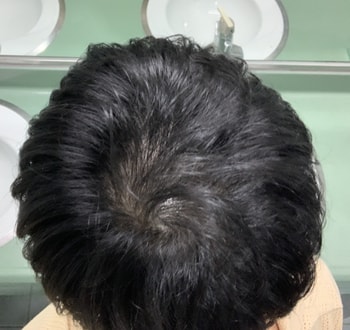 문신 후