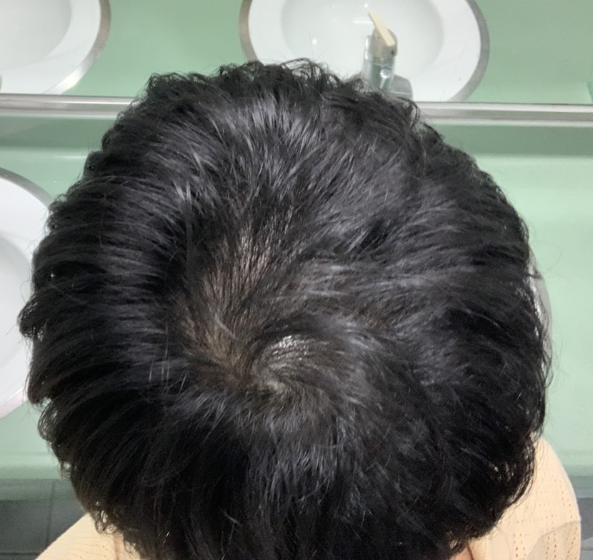 문신 후