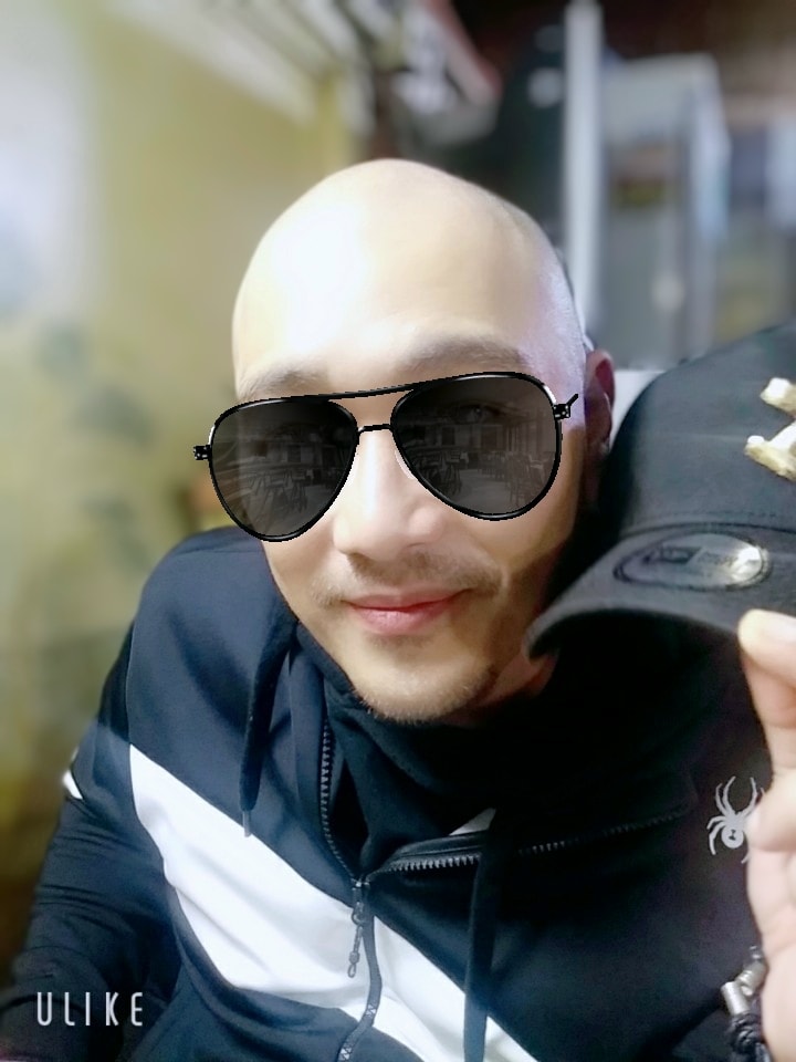 수개월 고민끝에 드디어 SMP두피문신했습니다.