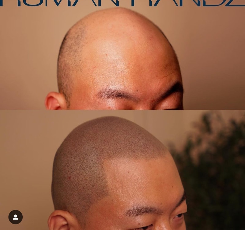Incheon Smp scalp tattoo (shaved) model get all free.