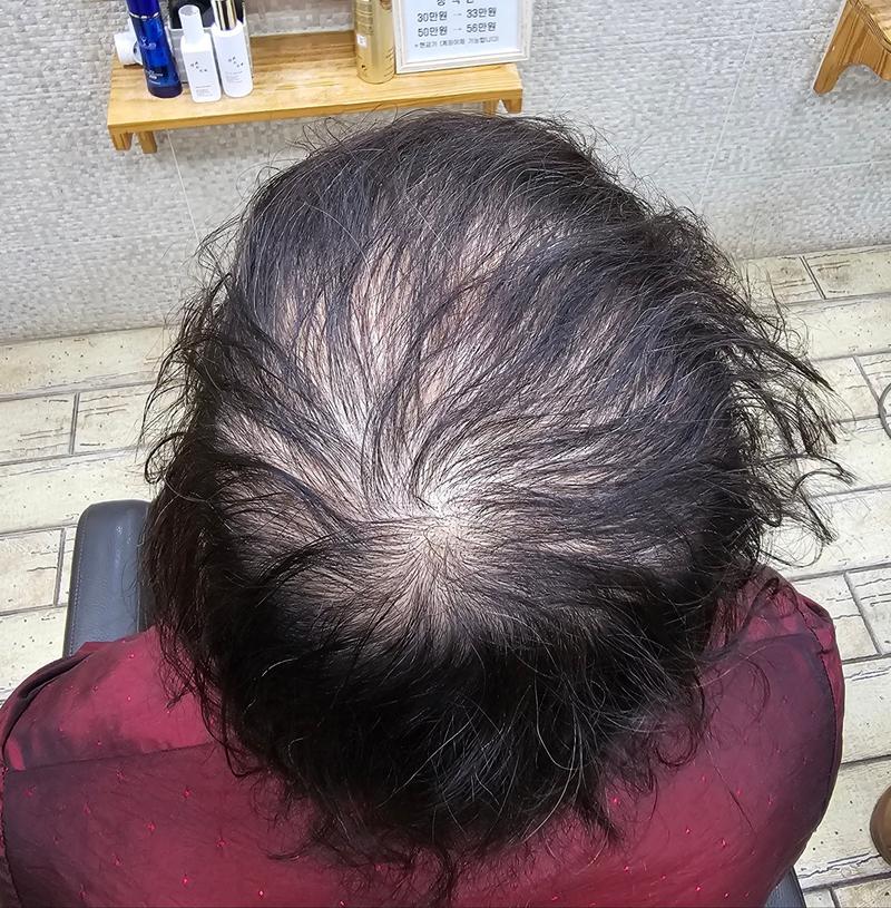 두피염색했어요~