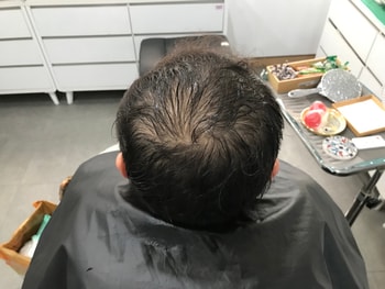 시술전 젖은상태