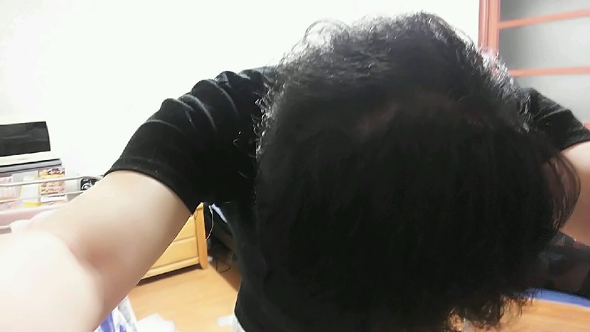 3,4차까지 리터치 받은 후입니다.