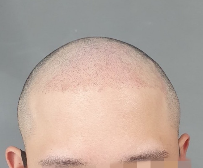 1차
