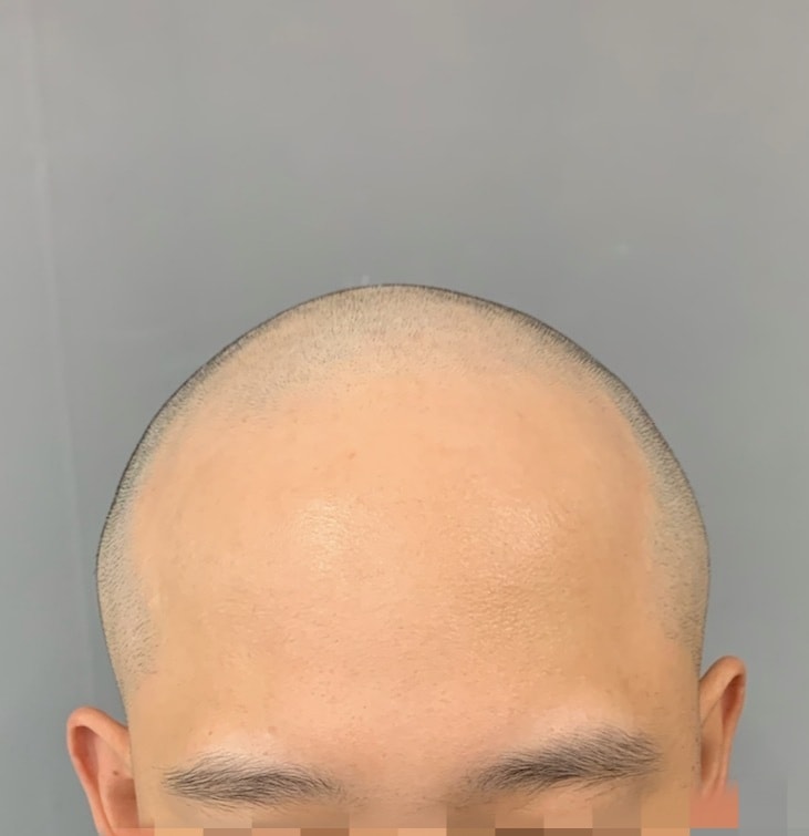 초기