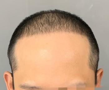 삭발전