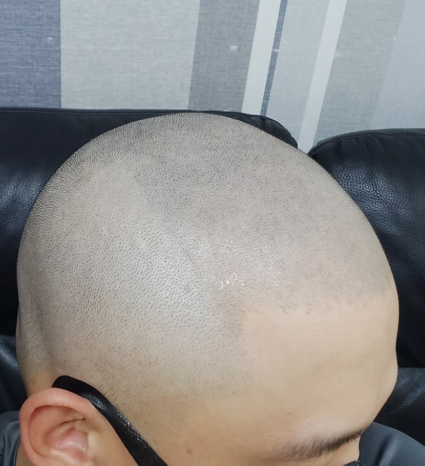 2차