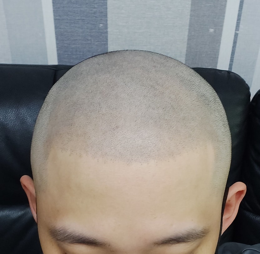 2차
