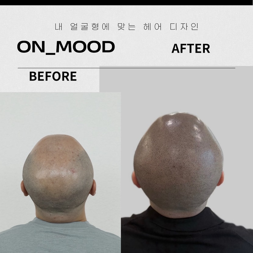 삭발 SMP