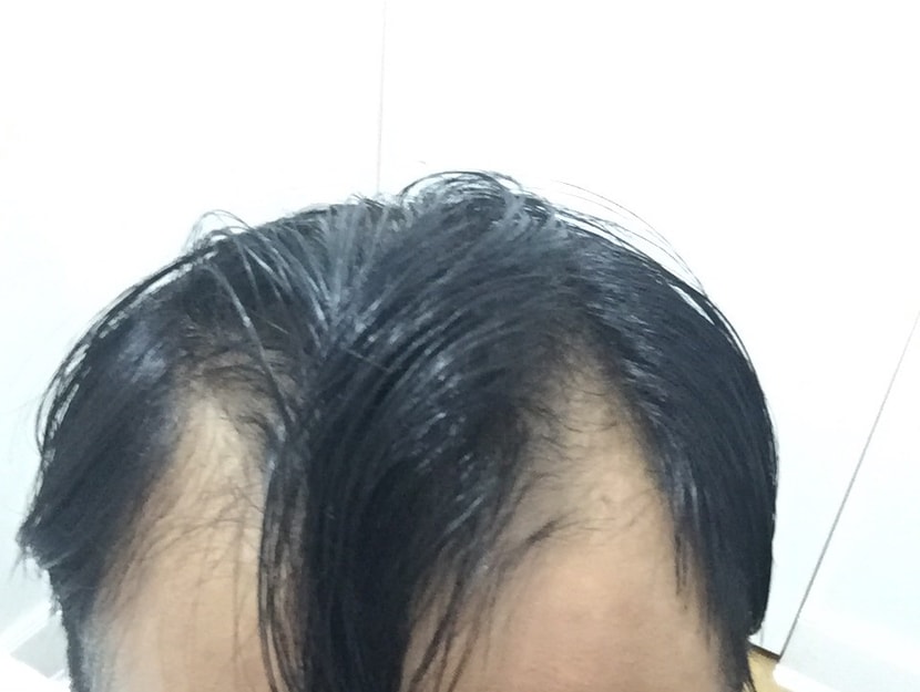 베지터 팬이었는데 속상해지네