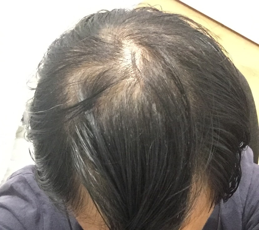 아 내가 남자다 호르몬 발사