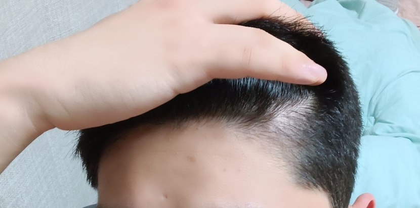 후