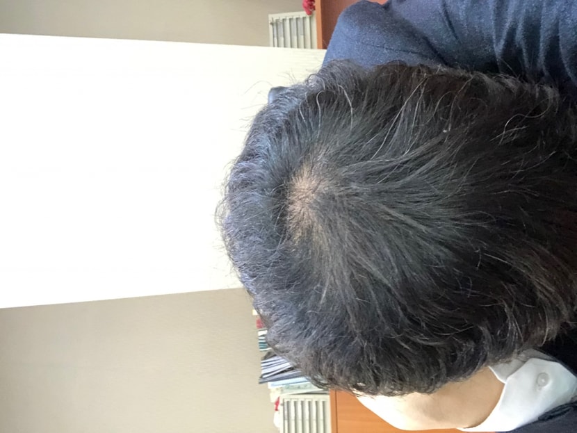 현재사진