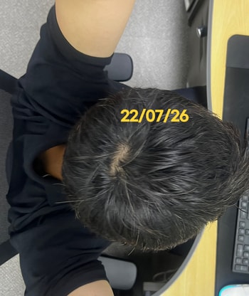 7월 정수리