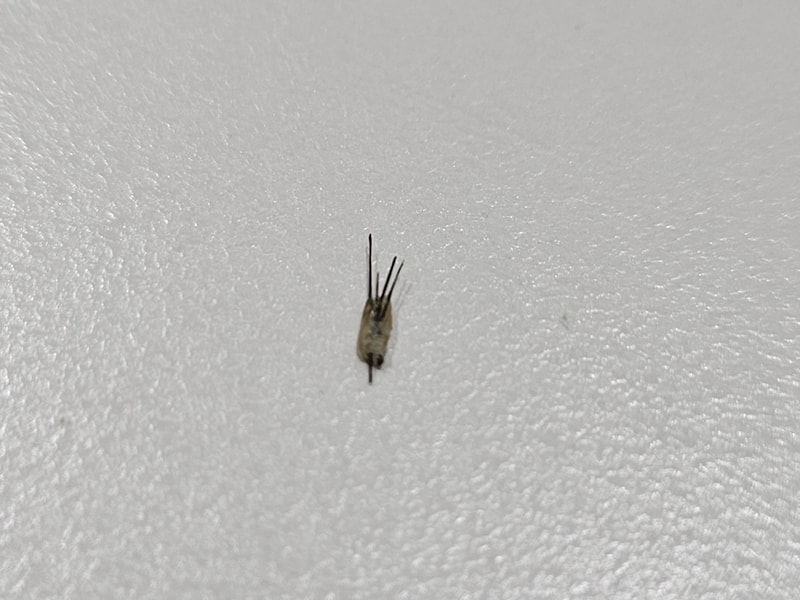 모낭 빠진 건가요?