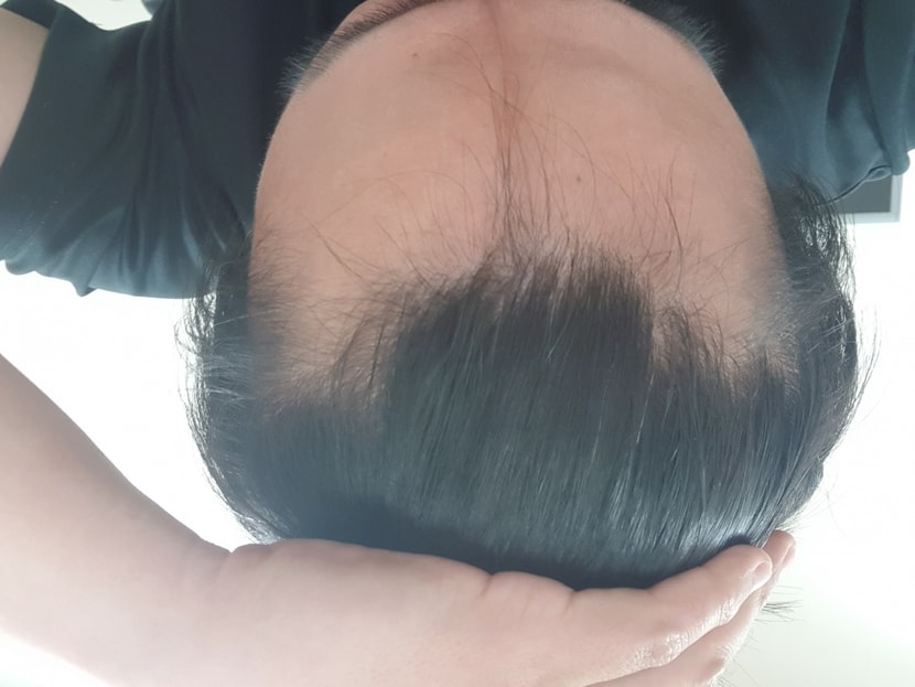 정면