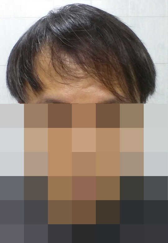 평상시 머리 내린 모습