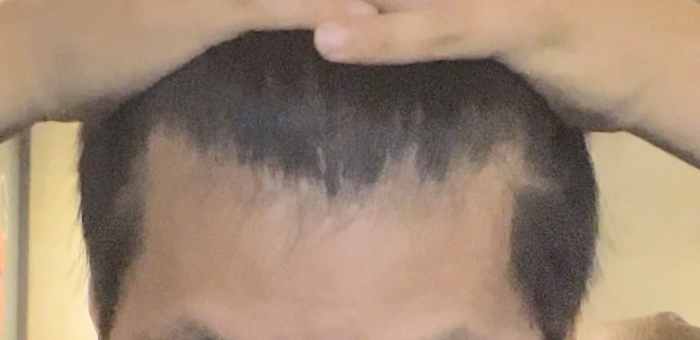 이건살짝숙인후 사진