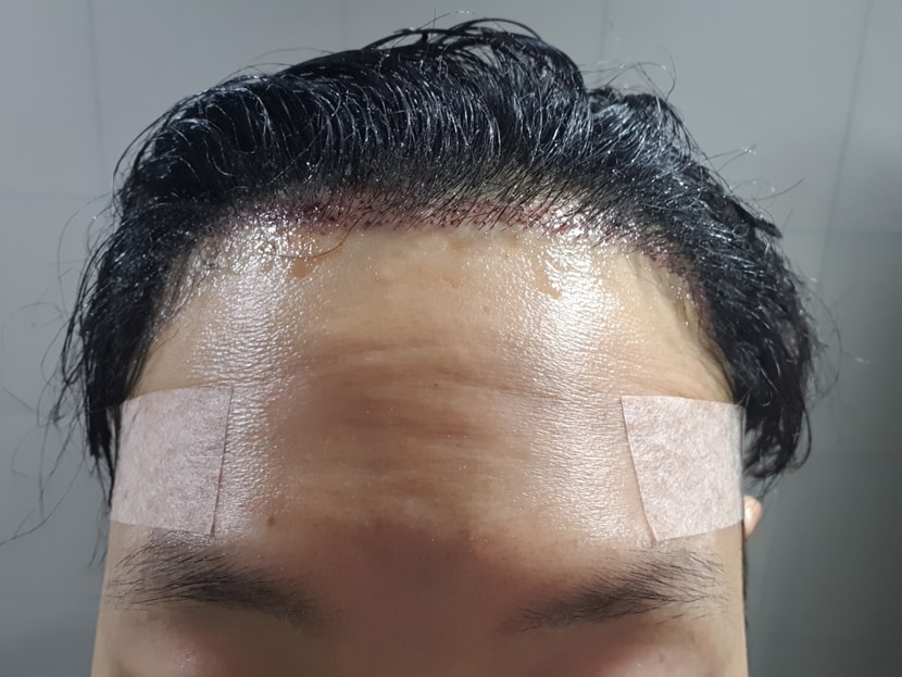 자라나라머리머리