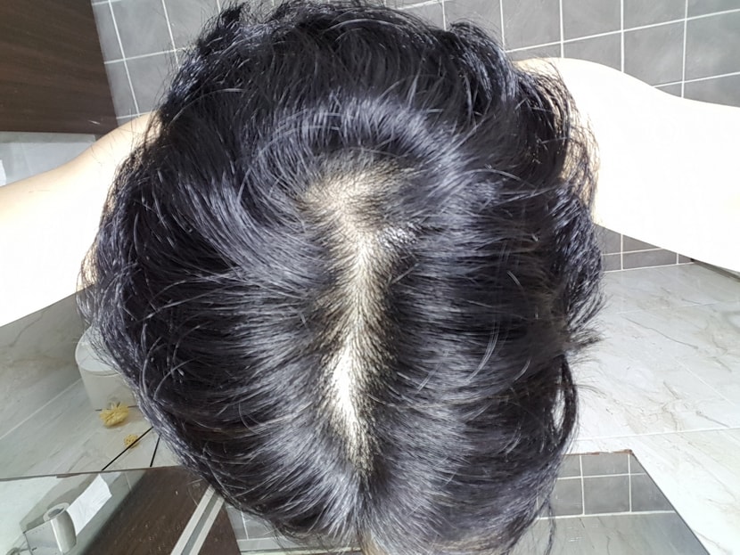 정수리.